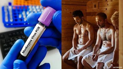 Spain Monkeypox Outbreak Linked to Pride Festival & Gay Sauna